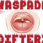 Gambar : Ilustrasi Penyakit Difteri_net