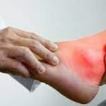 Gambar : Ilustrasi Pengobatan Asam Urat_net