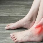 Gambar : Ilustrasi Terkena Asam Urat_net